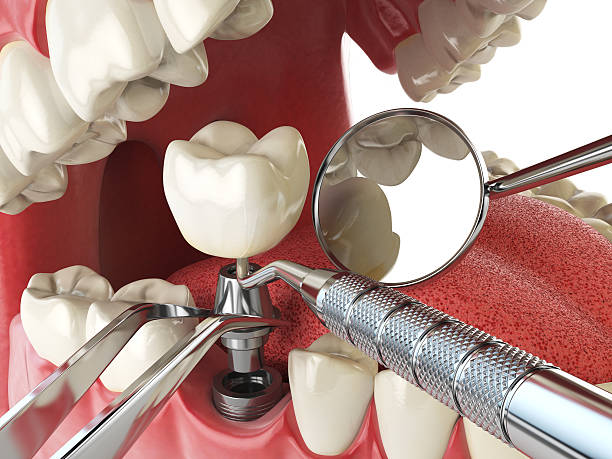 Trusted CA Emergency Dentist Experts